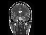 M E Z E R Y: Trailer