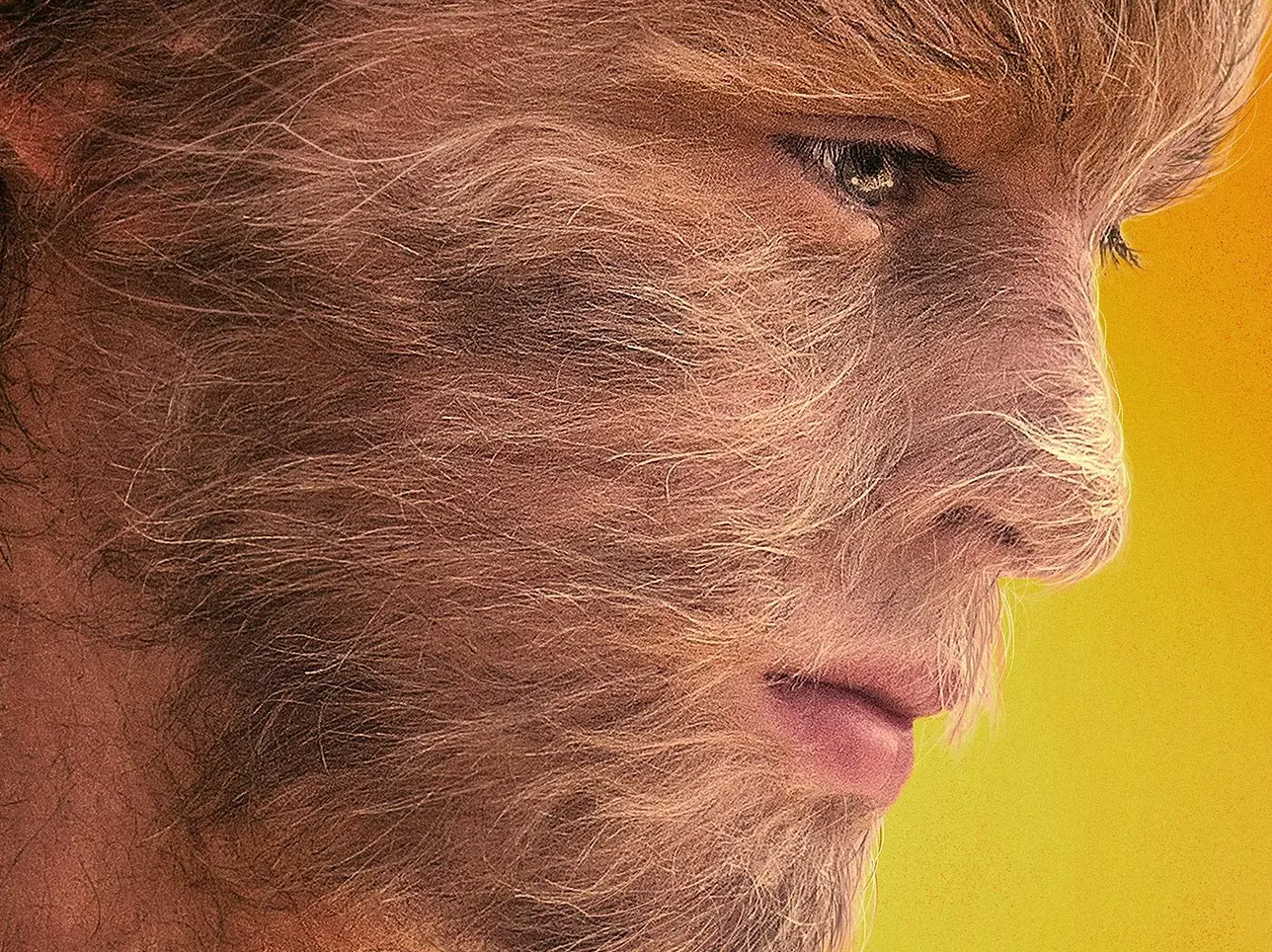 Nebojme se vlkodlačího syndromu. Jeden z nejuznávanějších českých reklamních režisérů natočil film věnovaný vzácné genetické poruše