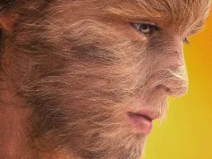 Nebojme se vlkodlačího syndromu. Jeden z nejuznávanějších českých reklamních režisérů natočil film věnovaný vzácné genetické poruše