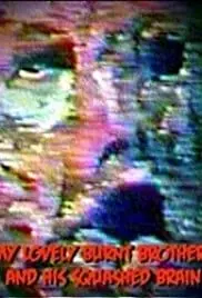 My Lovely Burnt Brother and His Squashed Brain