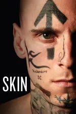 Skin/head
