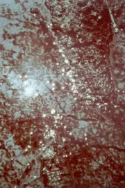 Du sang, de la volupté et de la mort, part II: Lysis