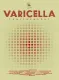 Varicella