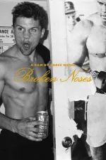 Broken Noses