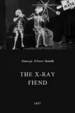X-Ray Fiend, The