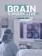 Operace mozku