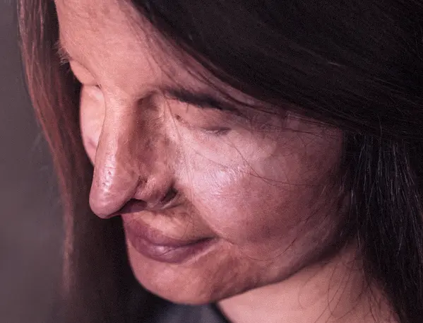 Život Češky po útoku kyselinou. Moje nová tvář chce nabídnout intenzivní zážitek