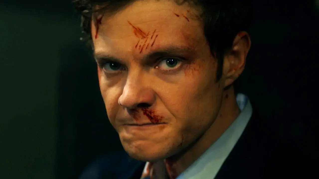 Recenze: Novokain je osvěžujícím soubojem různých žánrů. Ukazuje lásku, krev... a žádnou bolest