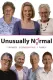 Unusually Normal