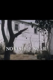 No Visible Scar