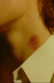 The Hickey