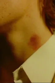 The Hickey