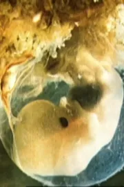 Schwangerschaft und Geburt