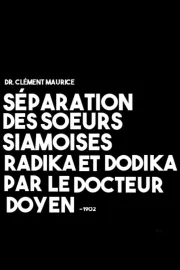 Séparation des soeurs siamoises Radika et Dodika par le docteur Doyen