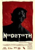Needleteeth