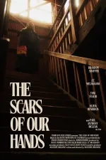 The Scars of Our Hands
