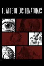 El Arte De Los Hematomas