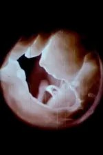 心 Heart (Radical 61)