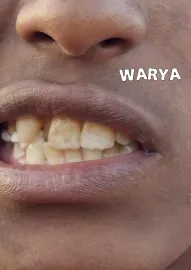Warya