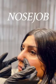 Nosejob